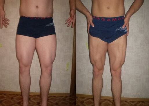 before and after the keto diet